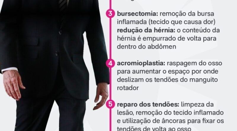 Bolsonaro deve apresentar melhora na segunda-feira