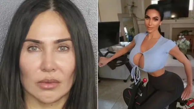 Brasileira é sentenciada nos Estados Unidos pela morte de sósia de Kim Kardashian durante procedimento estético
