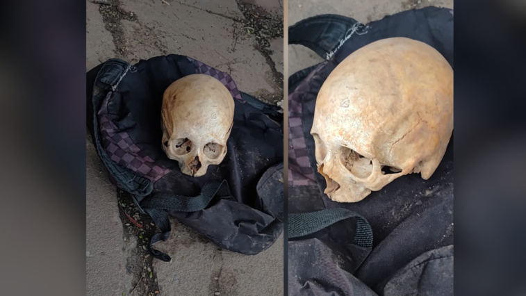 Cráneo humano é descoberto em ponto de ônibus em São Leopoldo