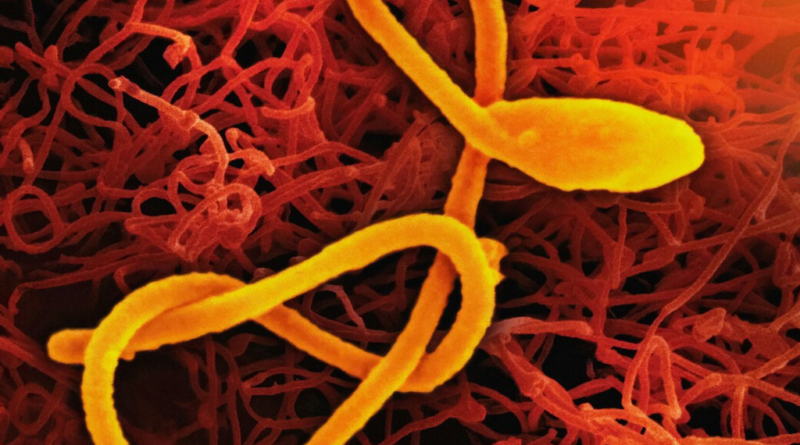 Epidemia de Ebola avança de forma acelerada, superando os esforços científicos para contê-la