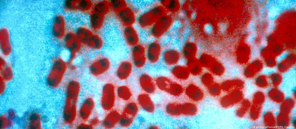 Yersinia pestis é causadora da peste pneumônica e da peste bubônica